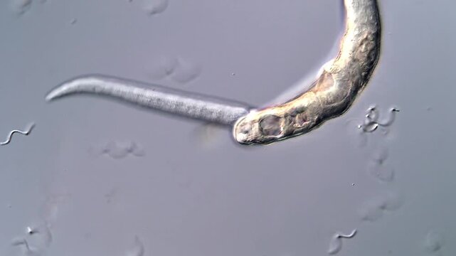 4K Microscope Footage of Schistosoma Larvae Swimming