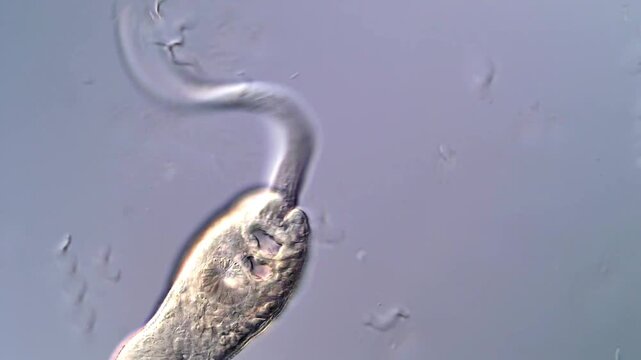 Fascinating Schistosoma Larvae Captured in 4K, from the snails sample 