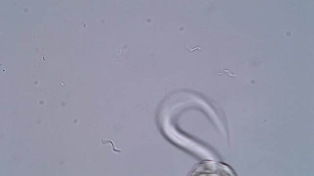 4K Microscopy Footage of Schistosoma Larvae Motion