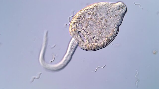 4K Microscopy of Cercariae Larvae of Fluke Parasites