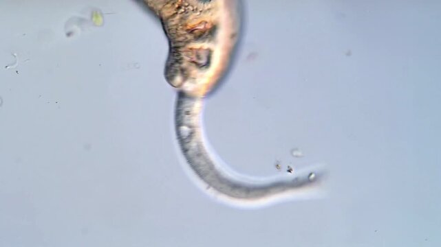 Parasite Larvae Under 4K High-Definition Microscope
