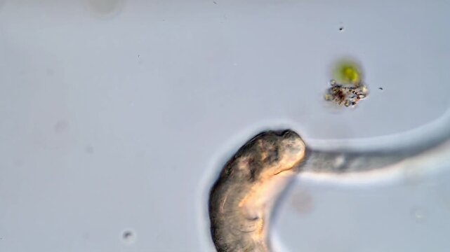 4K Video of Trematodes Larvae in Water,  Human parasite 