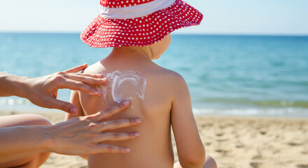 Child on summer beach with sunscreen applied to back
