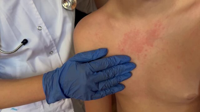 The boy's skin is covered with a rash that needs diagnosis.