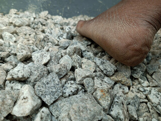 Cracked heels of an African or black person on gravels. Cracked heels known as heel fissures.