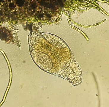 Brightfield micrograph of rotifer at 500x magnification