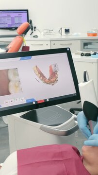 Dentist scans the patient's teeth using the CEREC scanner. Modern dentistry. The dentist uses a 3D dental intraoral scanner to scan the patient's teeth