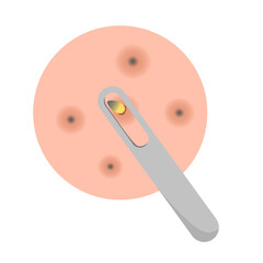 Acne facial type concept. vector illustration