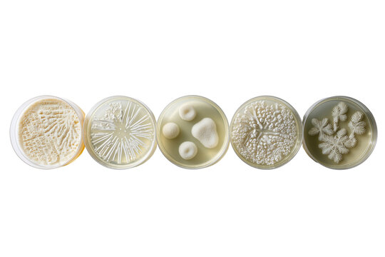 Perri Dish Fungi Growth, Microscopic Patterns, White Mold Colonies, Scientific Research on Transparent Background