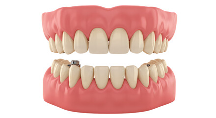 Fototapeta premium Realistic human dental model showing a complete set of upper and lower dentures isolated on white background