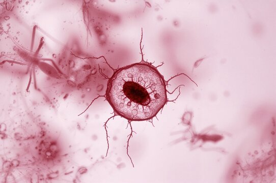 Blood smear showing Plasmodium falciparum gametocyte