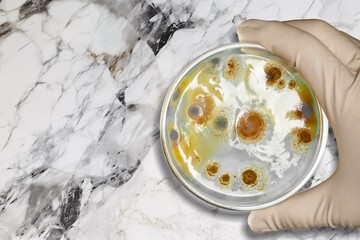 The rise of antibiotic bacterial infections in Petri dish