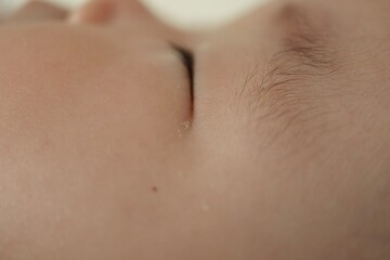 生後6か月の赤ちゃんの顔の目やに。クローズアップ写真。