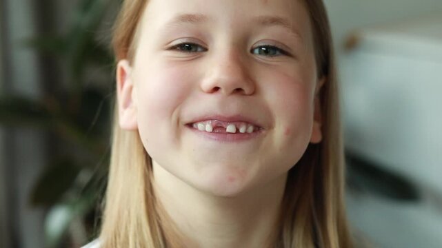 A happy little girl smiles, showing the loss of a baby tooth. Replacing baby teeth with molars