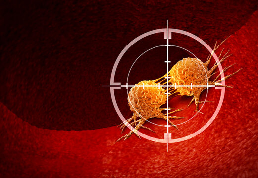 Oncology Medical Science fighting Cancer and malignant tumors with surgical removal or radiation treatment to eliminate cancerous cells as a symbol of Immunology with immunotherapy or chemotherapy.