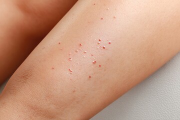 Close-up of skin with numerous small red dots