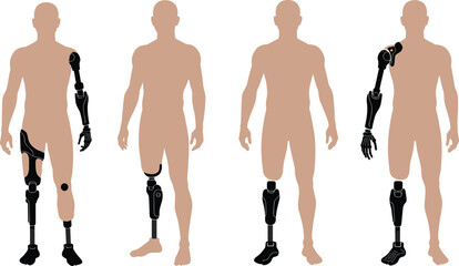 Vector illustration of diverse human figures with various prosthetic limbs, highlighting modern artificial limb technology, rehabilitation, mobility, and accessibility concepts
