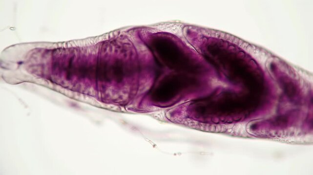 Microscopic view of a flatworm