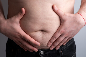Naklejka premium Сlose-up of a man's abdomen, with stretch marks or cellulite visible on the waist. Concept of medicine and treatment