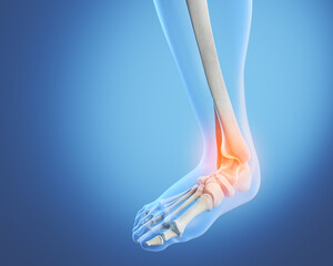 X-ray of a blue human ankle with painful spots highlighted in red, 3d illustration.