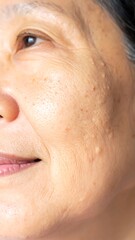 Fototapeta premium Close-up of skin with blemishes