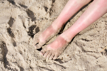 Sunlit sand-covered feet at beach