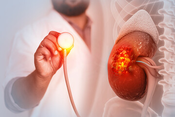 Doctor check and diagnose the human kidneys on blurred background. kidney cancer. 3d illustration