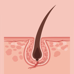Illustrative image displaying a cross-section of skin with a dark brown hair follicle