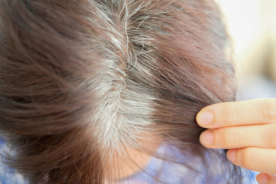 Mature woman with dark hair and visible gray roots, thinning hair, hair loss, female health, aging changes, visible scalp, hormonal hair loss