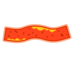 Illustration of Cholesterol in Blood