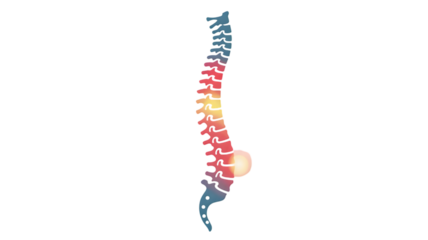 Human Spine Anatomy with Lumbar Pain Illustration