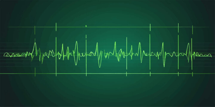 Green ECG line showing a heartbeat pulse on a medical monitor