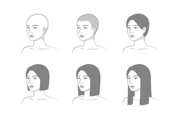 Hair growth stages of woman from bald to long hairstyle, beauty process female model illustration