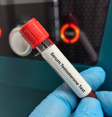 Blood sample for Testosterone test. Heathcare or medical concept. Sex hormone.