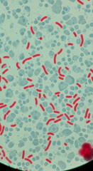 Vibrant red rod-shaped bacteria seen under microscope with light blue cellular background
