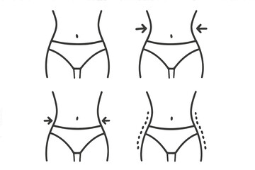 Weight loss line icon set. Body contouring, slimming concept. Woman waist before and after diet, liposuction. Female figure transformation. Fat removal plastic surgery vector.