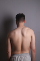 A man with a visibly curved spine, showing signs of poor posture or scoliosis. The person stands in front of a neutral background, highlighting the misalignment of the back.