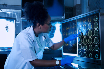 Female medical radiologist doctor looking head and brain x-ray film before surgery in lab office at...