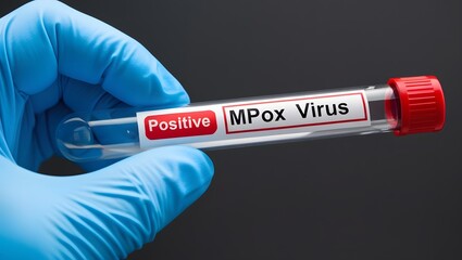 Fototapeta premium Mpox virus test , AI Generated.