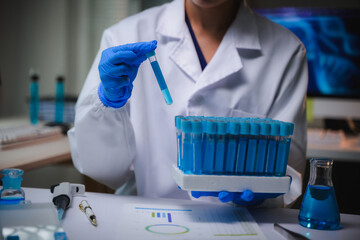 Scientist holding a test tube with blue liquid, performing medical analysis in a laboratory for research and development