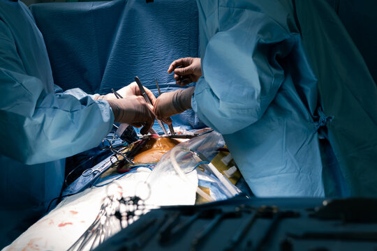 Surgeons hold surgical equipment in minimal invasive heart surgery, blue light. Concept mini invasive  thoracotomy cardio-thoracic surgery banner. Healthcare and medical process. High quality photo