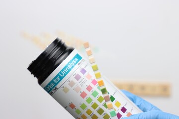 Urinalysis strips to test urine sample in a light background and copy space