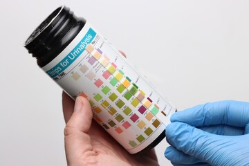 Urinalysis strips to test urine sample in a light background and copy space