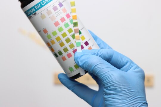Urinalysis strips to test urine sample in a light background and copy space