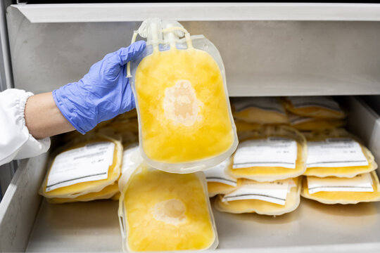 Close up scientist hand wear blue gloves holding fresh frozen plasma bag in storage refrigerator at blood bank unit laboratory.Blood bag received from blood donation used in patients.Save life concept - Powered by Adobe