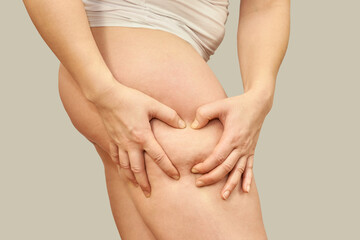 Female adult showing cellulite on thigh and skin texture close-up against neutral background.