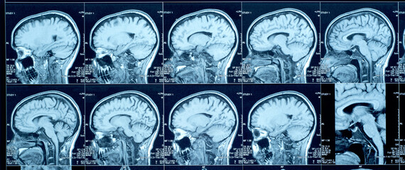 Closeup of a CT scan with brain. Magnetic resonance imaging. Medical, science and education mri brain background. Magnetic resonance imaging. © Tryfonov