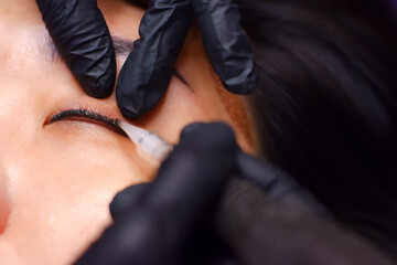 Tattooing the eyelids with a machine.