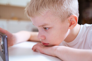 A boy with hearing aids engages with a smartphone, playing mobile games with focused enjoyment....
