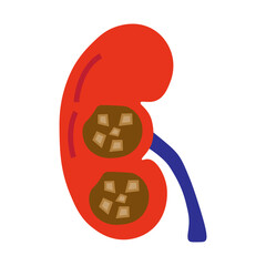 chronic kidney stone disease